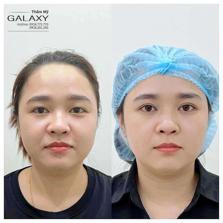 Thẩm mỹ viện Galaxy