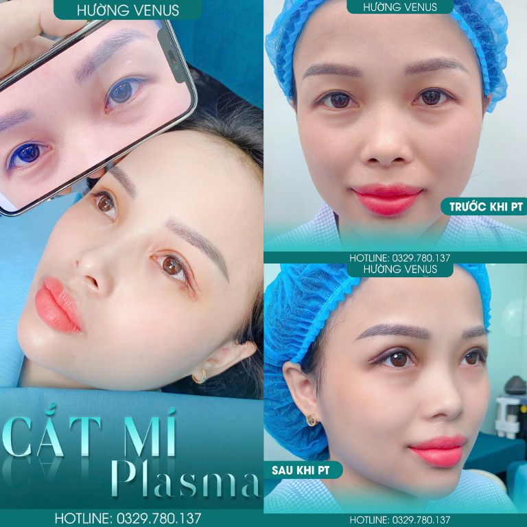 Thẩm mỹ viện Hường Venus