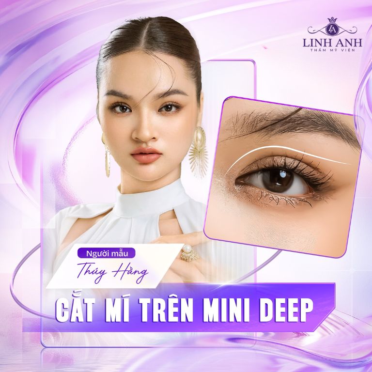 Thẩm Mỹ Quốc Tế Linh Anh