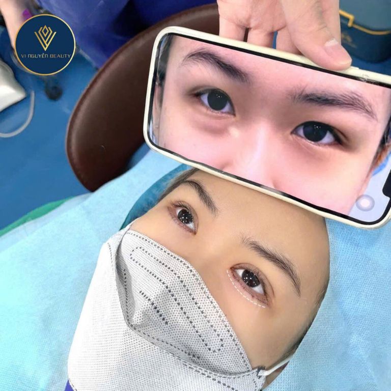 Thẩm mỹ viện Vi Nguyễn