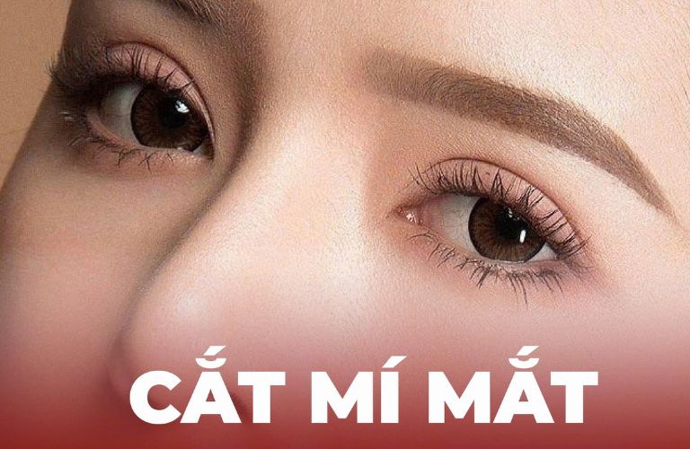 Giới thiệu 5 địa chỉ cắt mí mắt đẹp và uy tín tại Lâm Đồng