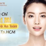 Cắt mí mắt ở đâu đẹp tại TPHCM