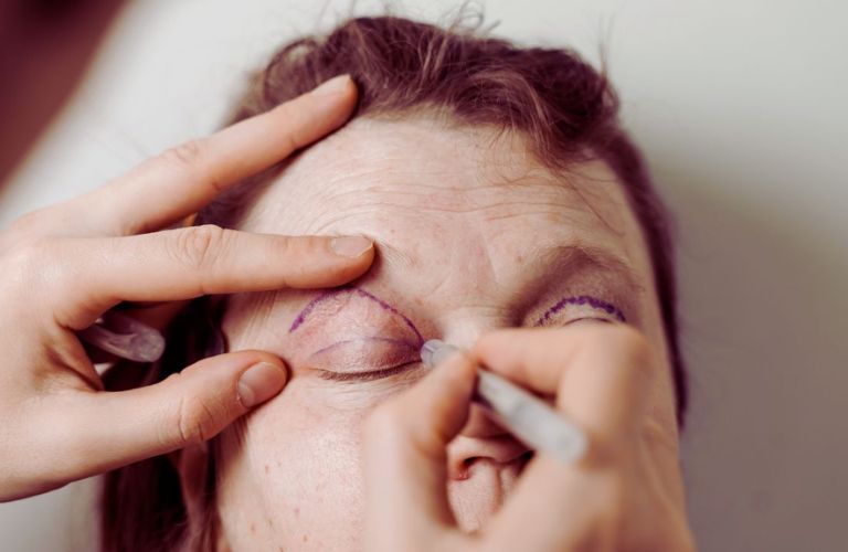 Thiết kế mí mắt không phù hợp