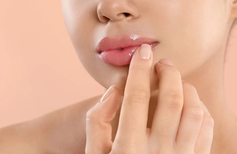 Giữ môi khô thoáng, không chạm tay bẩn vào môi và không tùy tiện dùng thuốc bôi