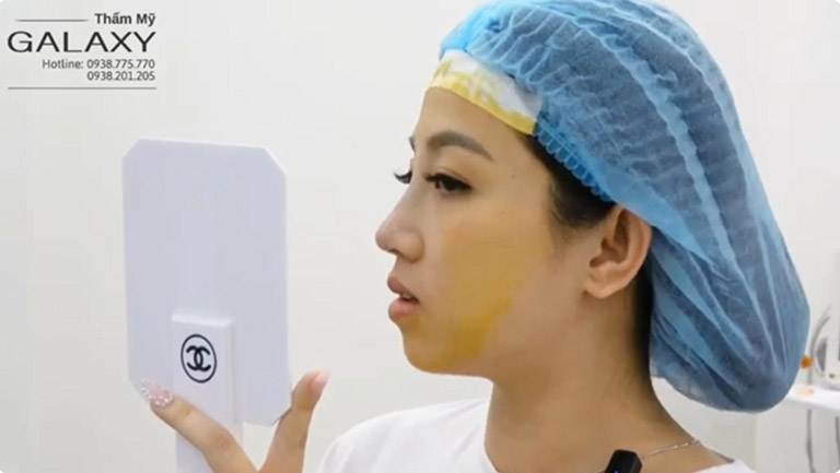 Thẩm mỹ Galaxy nâng mũi tại Bà Rịa Vũng Tàu