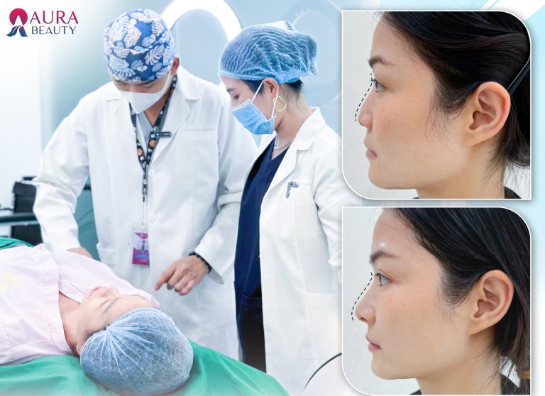 Thẩm Mỹ Viện Aura nâng mũi tại Đồng Tháp