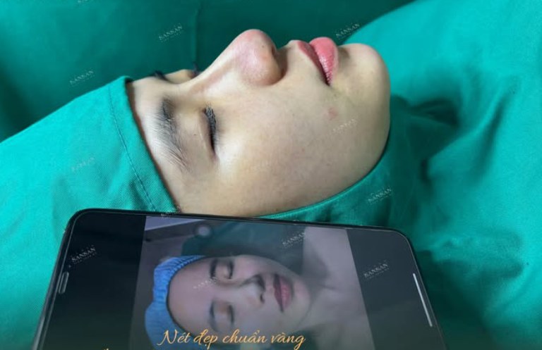 Viện Thẩm Mỹ Quốc Tế San San là địa chỉ chuyên nâng mũi ở Đồng Tháp