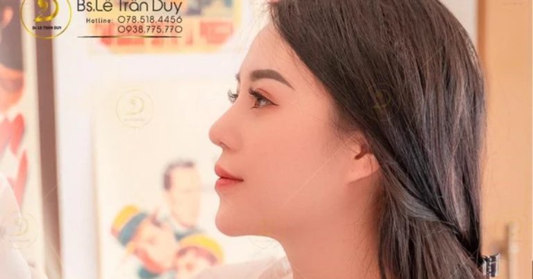 Nâng mũi ở Đồng Tháp có tốt không