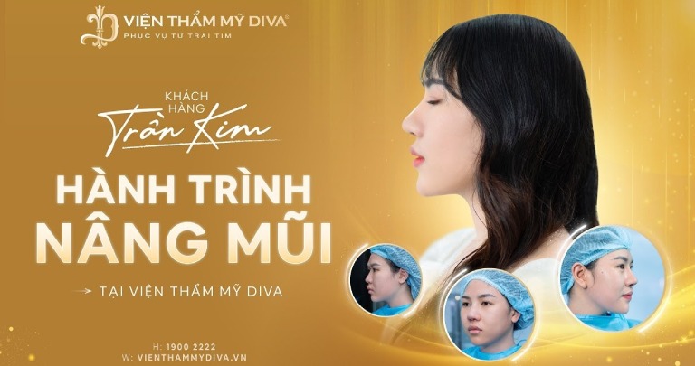 Viện Thẩm Mỹ Diva là địa chỉ nâng mũi đẹp ở Hóc Môn