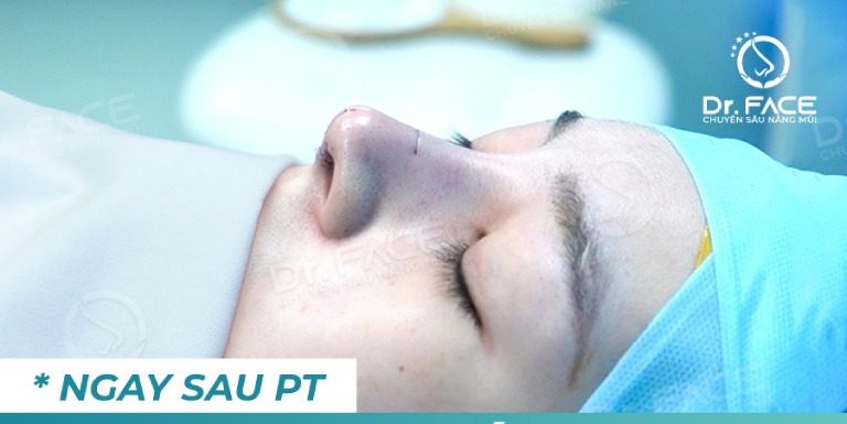 Địa chỉ nâng mũi ở Quận 10 Dr.Face