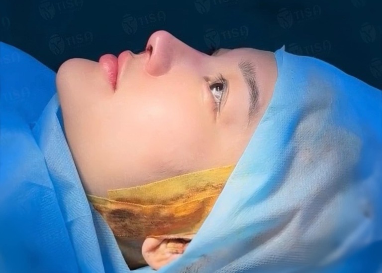 Tisa Beauty & Clinic nâng mũi ở Tân Phú
