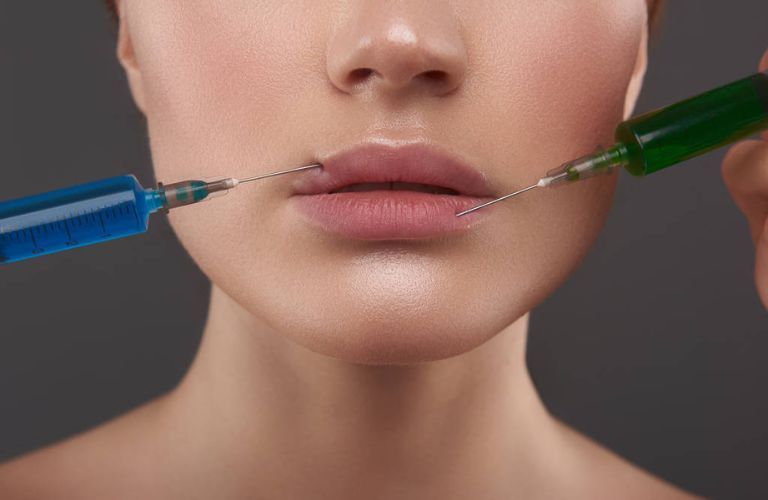 Tiêm filler giúp tạo dáng môi tều rõ rệt và nhanh chóng