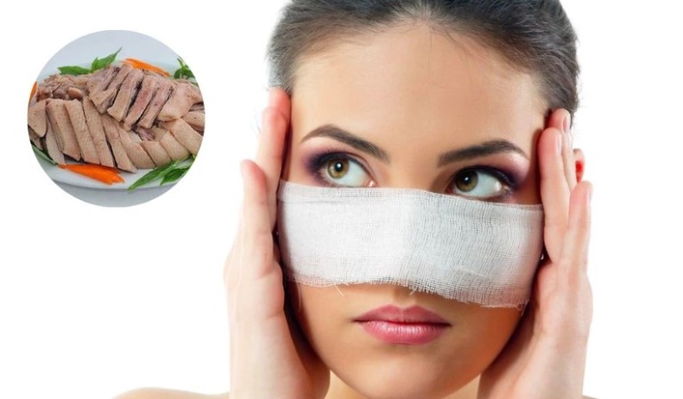 Sau nâng mũi ăn thịt vịt được không