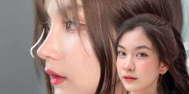 nâng mũi bao lâu thì hồi phục