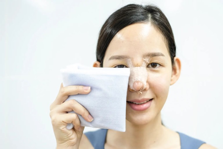 chườm lạnh giảm bầm mắt sau nâng mũi