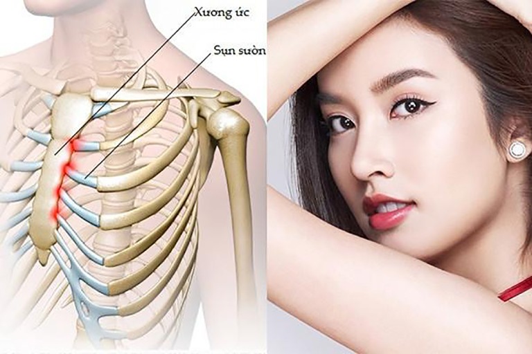nâng mũi s line đẹp