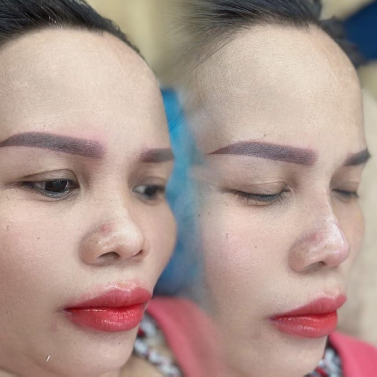 Beauty Spa Bảo Hạnh nâng mũi giá rẻ tại An Giang