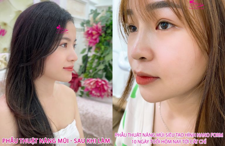 Thẩm Mỹ Viện Mailisa