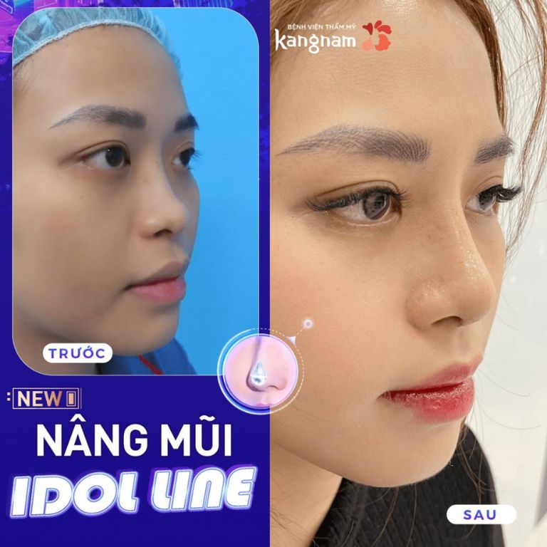 Viện Thẩm Mỹ Kangnam Bình Dương