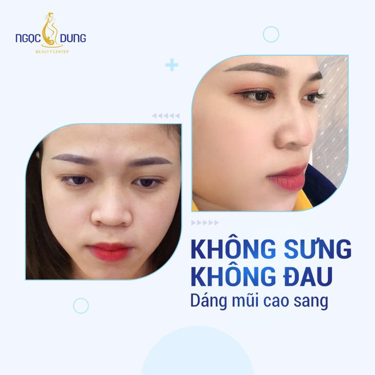 Thẩm mỹ viện Ngọc Dung