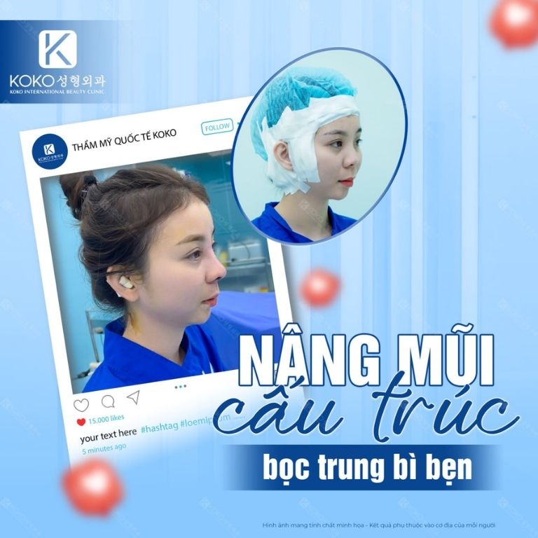 Thẩm Mỹ Quốc Tế KOKO