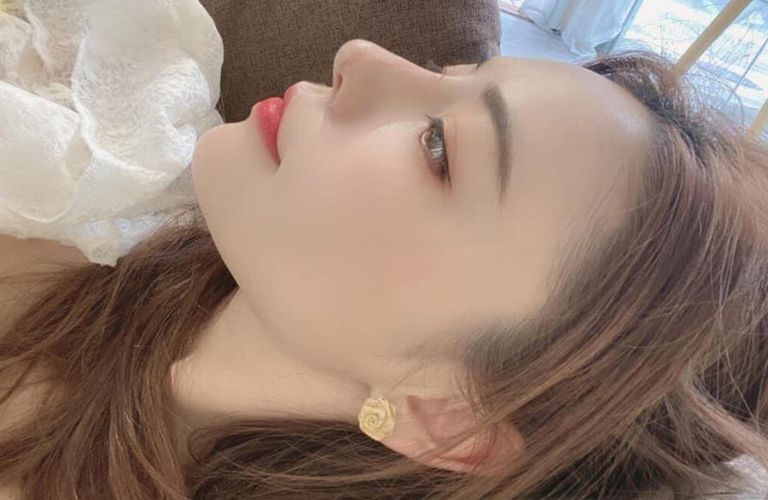 Lựa chọn những địa chỉ nâng mũi bằng các phương pháp hiện đại, mang đến hiệu quả rõ ràng