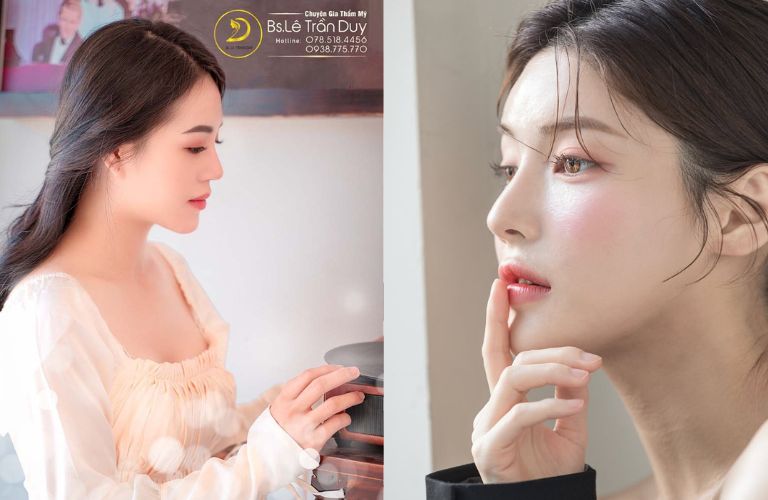 Các dáng mũi do Bác sĩ Lê Trần Duy thực hiện tại Thẩm mỹ viện Galaxy