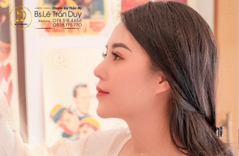 Phương pháp nâng mũi điêu khắc Dr.Duy