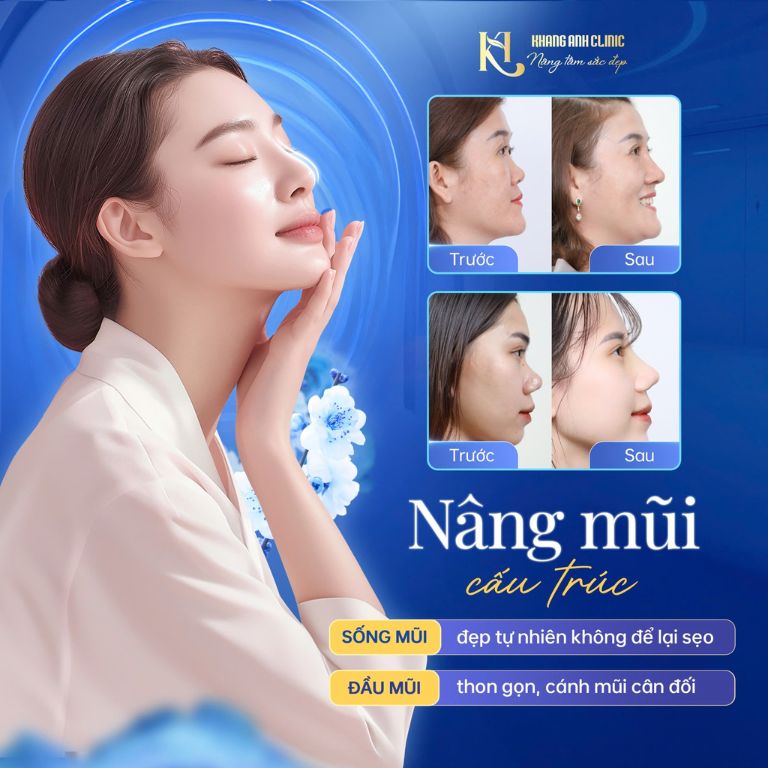 Thẩm mỹ Khang Anh