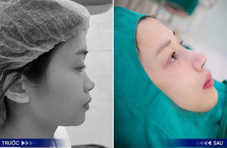 Xem phản hồi và hình ảnh thực tế của khách hàng