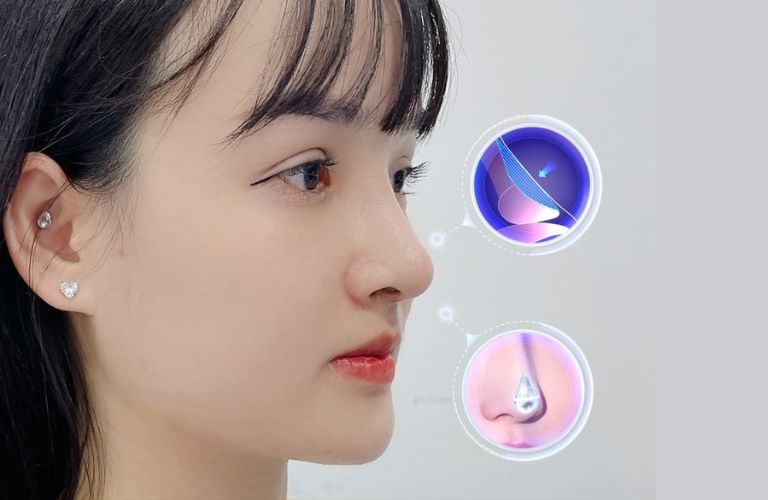 Chọn địa chỉ nâng mũi dựa trên tay nghề bác sĩ, công nghệ được áp dụng