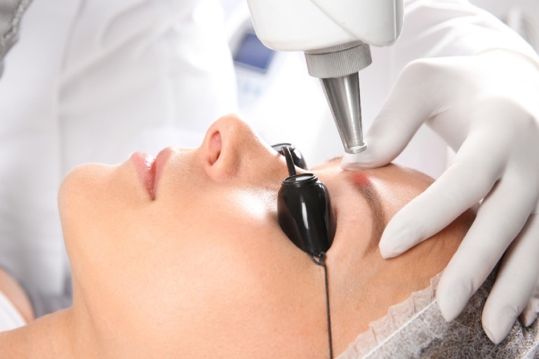 Cách nhổ lông mày an toàn để không bị sụp mí
