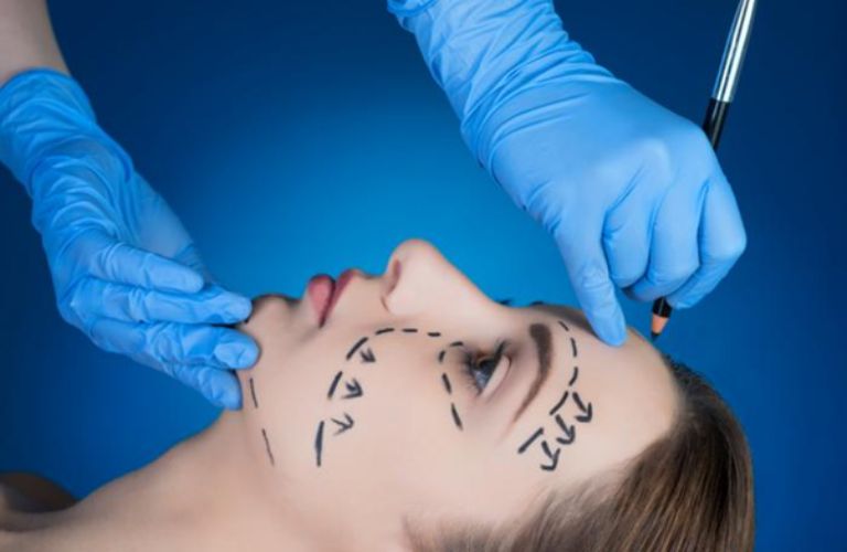 Phẫu thuật căng da mặt toàn phần