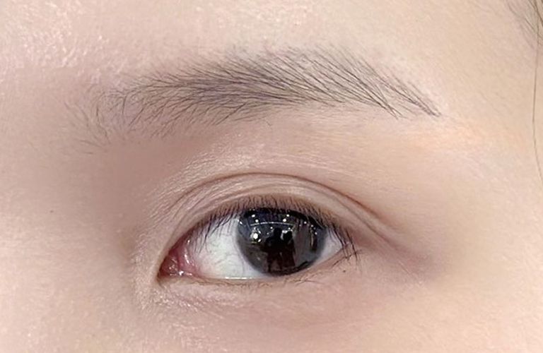 Người có lông mày thưa, nhạt màu hoặc không đều