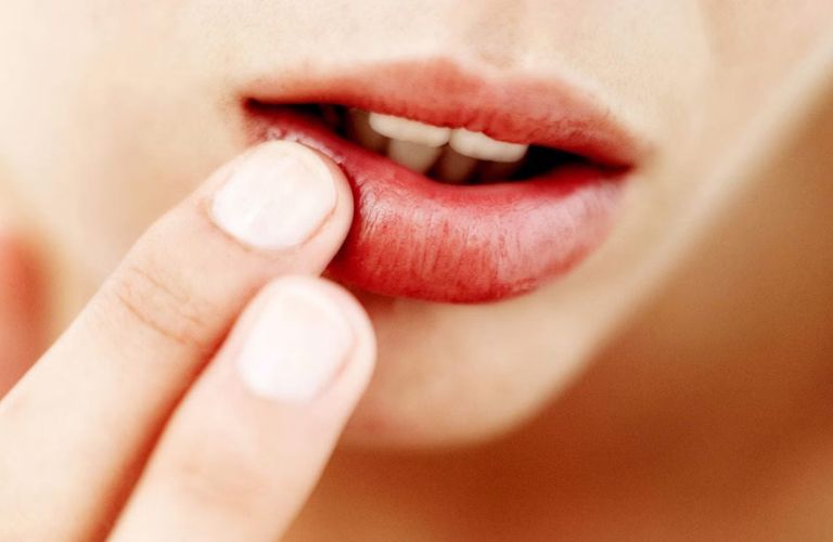 Ăn đồ nếp sau phun môi có thể gây triệu chứng hoặc không