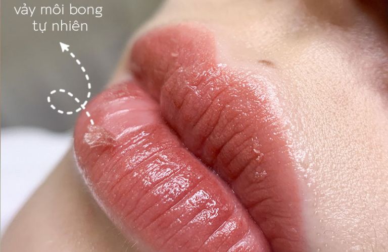 Đảm bảo quá trình bong vảy diễn ra tự nhiên