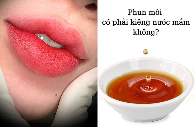 Mới phun môi cần kiêng ăn nước mắm