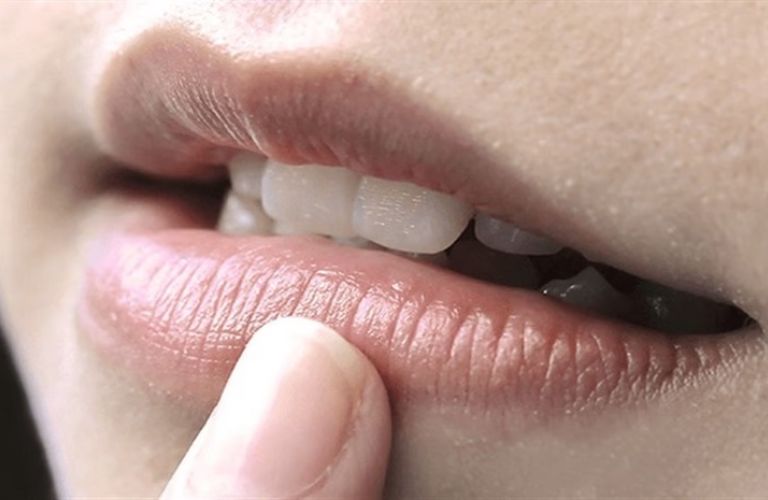 Việc ăn nước mắm sớm sau khi phun moi có thể làm thâm môi, môi xỉn màu
