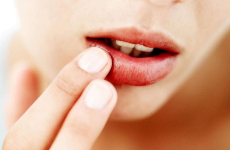 Kích thích phản ứng viêm nhẹ hoặc làm chậm quá trình lành da