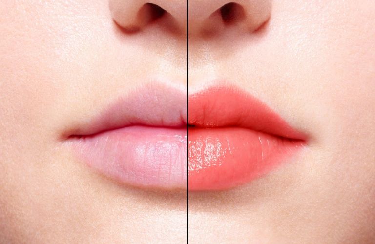 Kỹ thuật phun môi màu hồng san hô có thể duy trì màu sắc đẹp từ 2 – 3 năm