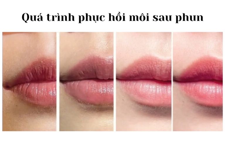 Tìm hiểu quy trình phục hồi môi sau khi phun xăm