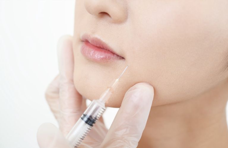 Quy trình tiêm Filler căng da mặt chuẩn