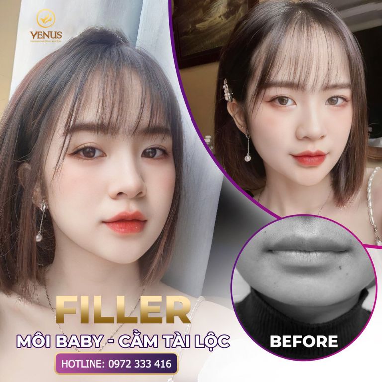 Thẩm mỹ Quốc Tế VENUS