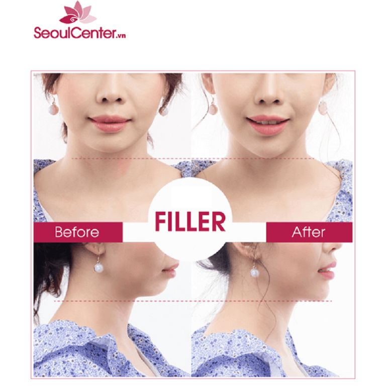 Viện Thẩm Mỹ YB SPA