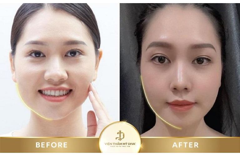 Viện Thẩm Mỹ DIVA