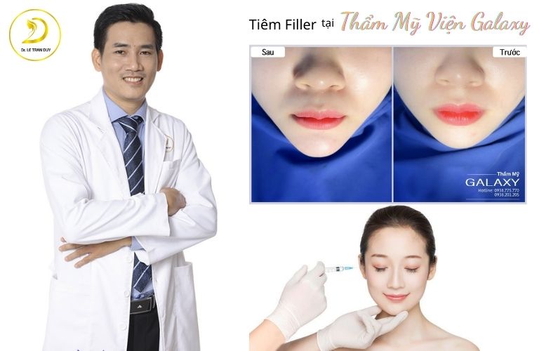 BS Lê Trần Duy trực tiếp tiêm filler tại Thẩm mỹ viện Galaxy