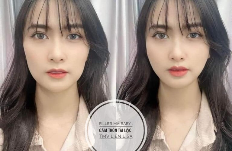 Thẩm Mỹ Viện Liên Lisa