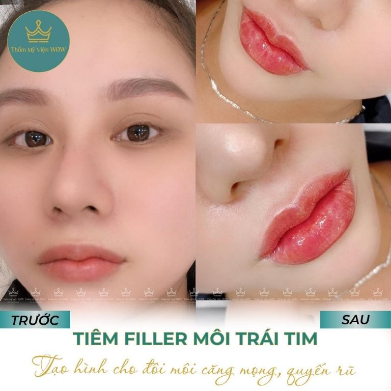 Phòng Khám Thẩm Mỹ Wow