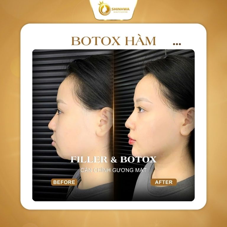 Viện Thẩm Mỹ Shinhwa