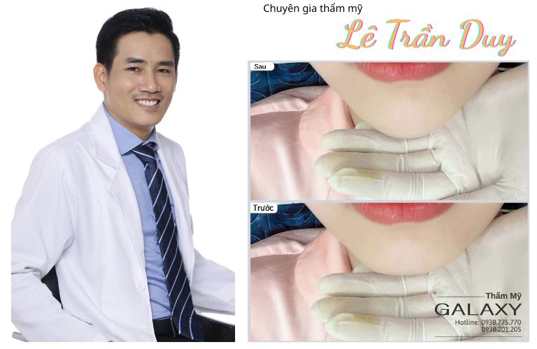 Bác sĩ Lê Trần Duy